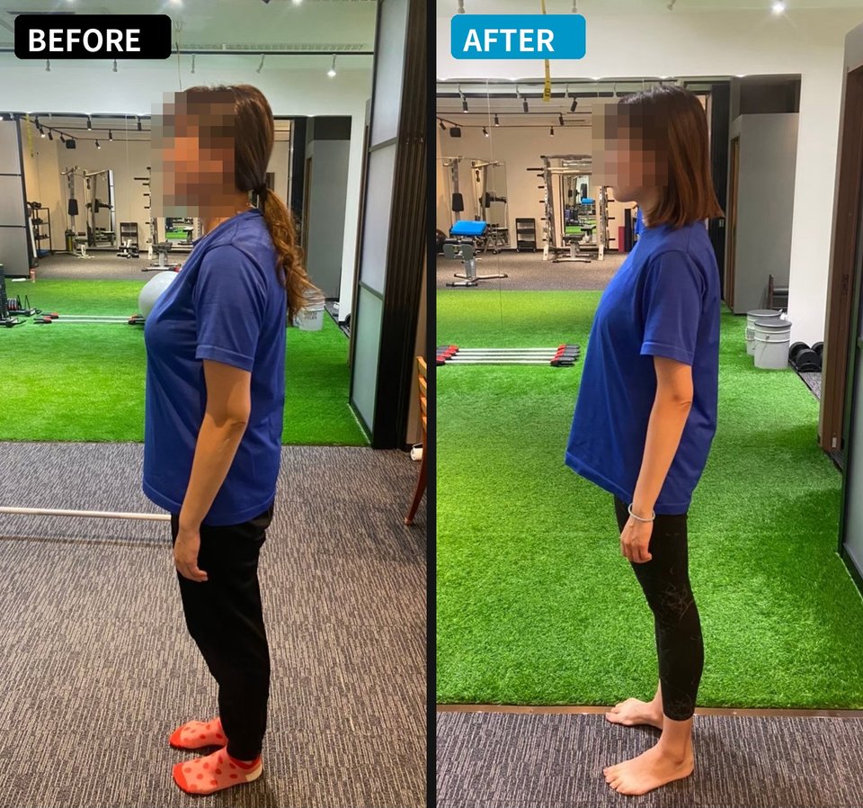 女性のビフォーアフター写真（9ヶ月で体重−17kg）